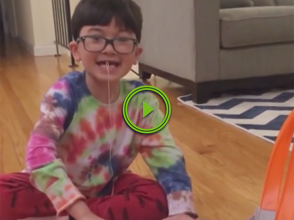 Little daredevil pulls tooth with hot wheels car