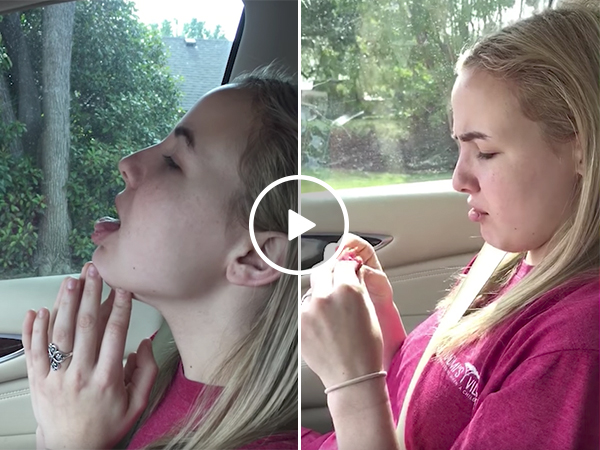 Girl thinks she's a lizard after surgery