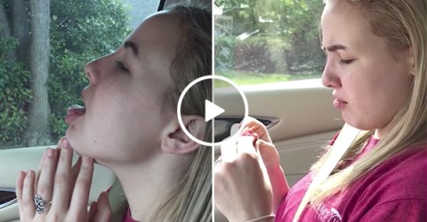 Girl thinks she's a lizard after surgery